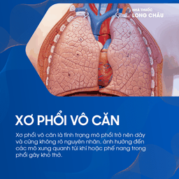 Xơ phổi vô căn 1