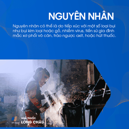 Xơ phổi vô căn 3