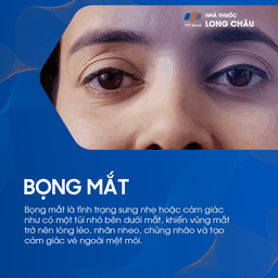 Bọng mắt là tình trạng sưng nhẹ dưới mắt, khiến mắt trông mệt mỏi, nhăn nheo và chùng nhão