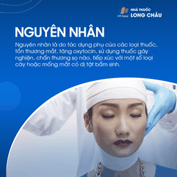 Giãn đồng tử 3