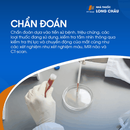 Giãn đồng tử 5