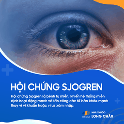 Hội chứng Sjogren 1