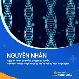 Hội chứng Sjogren 3