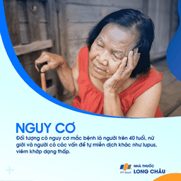 Hội chứng Sjogren 4