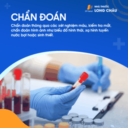 Hội chứng Sjogren 5
