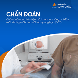 Màng trước võng mạc 5