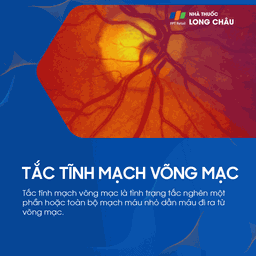 tắc tĩnh mạch võng mạc 1