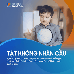Tật không nhãn cầu 1