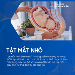 Tật mắt nhỏ 1