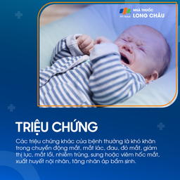 U nguyên bào võng mạc 3