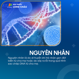 U nguyên bào võng mạc 4