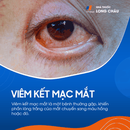 Viêm kết mạc mắt 1