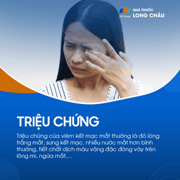 Viêm kết mạc mắt 2