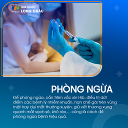 Viêm mô tế bào quanh hốc mắt 7