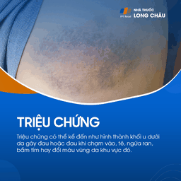 Giả phình mạch 3