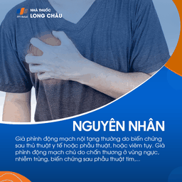 Giả phình mạch 2