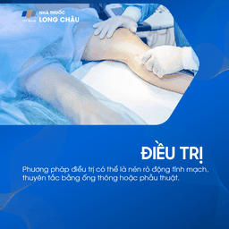 Rò động tĩnh mạch 6