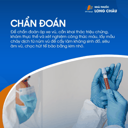 Chẩn đoán áp xe vú bằng khám lâm sàng, siêu âm, xét nghiệm máu và cấy dịch từ núm vú