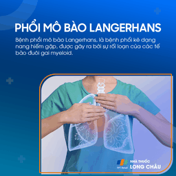Bệnh phổi mô bào Langerhans 1