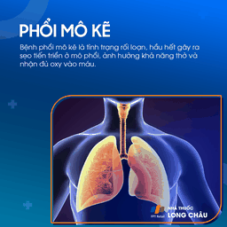 Phổi mô kẽ 1