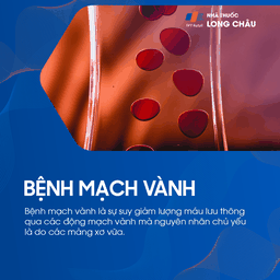 Mạch vành bị hẹp do mảng xơ vữa làm cản trở lưu thông máu