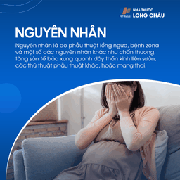 Các yếu tố như chấn thương, nhiễm trùng hoặc bệnh lý cơ học có thể kích hoạt đau dây thần kinh liên sườn