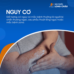 Nhóm người có nguy cơ cao bao gồm vận động viên, người lao động nặng