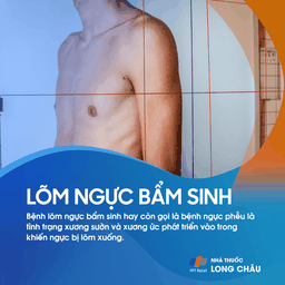 Lõm ngực bẩm sinh 1