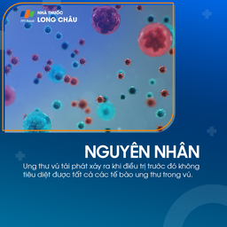 Ung thư vú tái phát 3