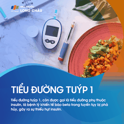 Tiểu đường tuýp 1 là bệnh lý mà tế bào beta của tuyến tụy bị phá hủy