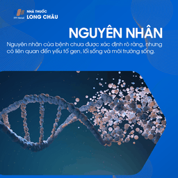 nguyên nhân gây ra tiểu đường tuýp 2, như lối sống ít vận động, chế độ ăn uống không lành mạnh và yếu tố di truyền