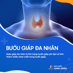 Bướu giáp đa nhân 1