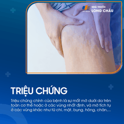 Loạn dưỡng mỡ 2