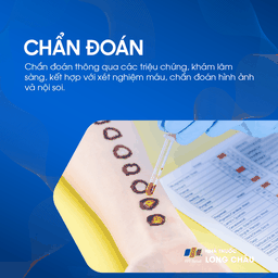 Tăng áp tĩnh mạch cửa 5