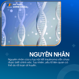 U tụy nội tiết Insulinoma 3