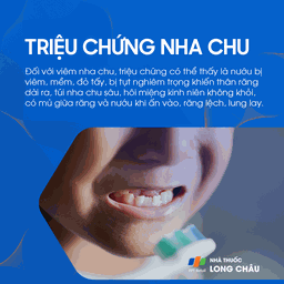 Bệnh nướu và nha chu 3