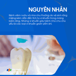 Bệnh nướu và nha chu 5