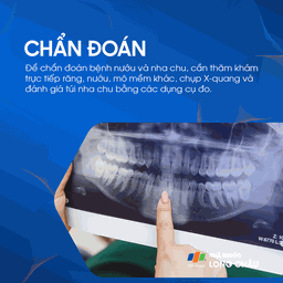Bệnh nướu và nha chu 7