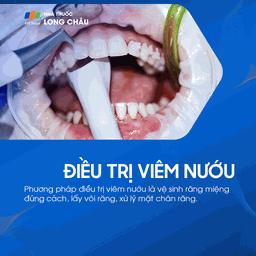 Bệnh nướu và nha chu 9