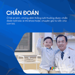 Dính thắng lưỡi 5