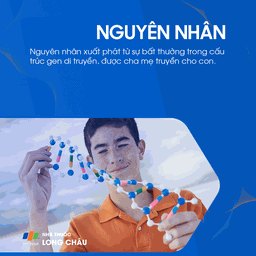 Hội chứng mắt mèo 3