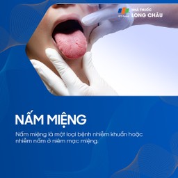 Nấm miệng 1