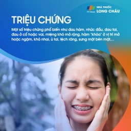 Rối loạn khớp thái dương hàm 2