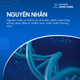 U men xương hàm 3