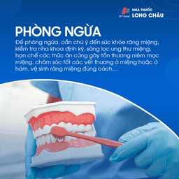 U men xương hàm 7