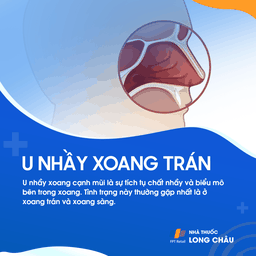 U nhầy xoang trán 1