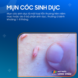 Mụn cơm (mụn cóc) sinh dục là một loại tổn thương trên niêm mạc hoặc da ở bộ phận sinh dục