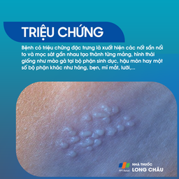 Các nốt sùi mào gà mọc thành cụm như súp lơ là triệu chứng điển hình của bệnh HPV sinh dục