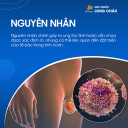 Ung thư tinh hoàn 3