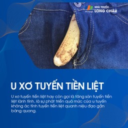 U xơ tuyến tiền liệt 1